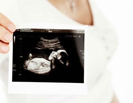 Ecografia Prenatale 3D e 4D