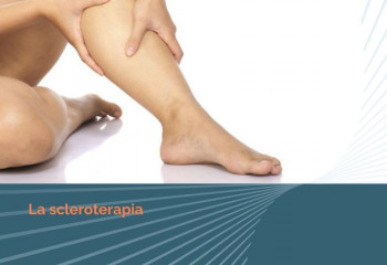 La Scleroterapia