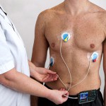 ECG Holter Cardiaco